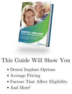 Best Dental Spa Dental Implants Guide